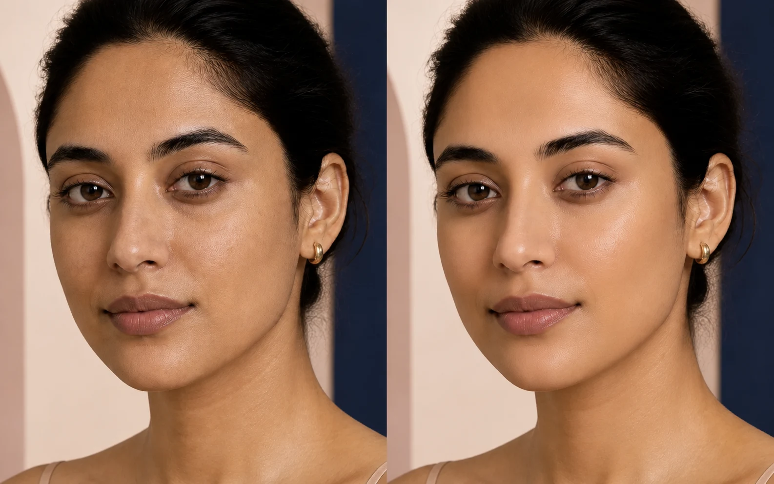 Illustrative before-and-after comparison focused on the appearance of visible pores on the same fictional adult model